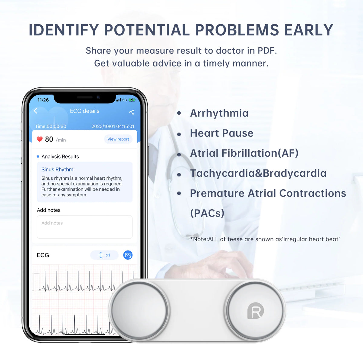 Handheld Bluetooth ECG Monitor with Screen Display F8379