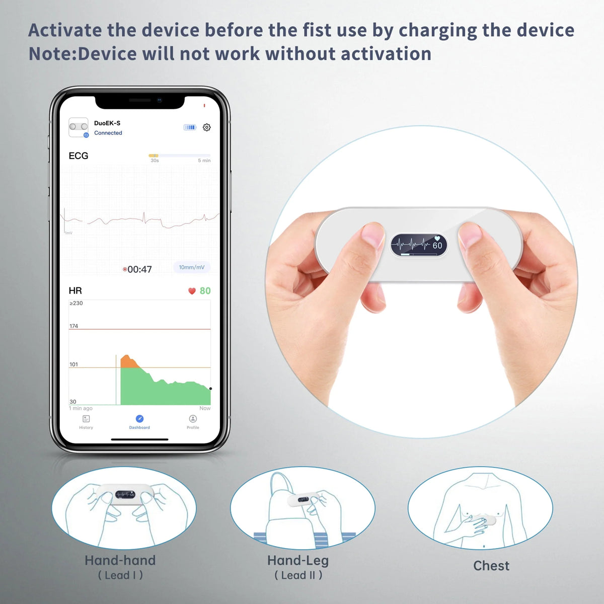 Handheld Bluetooth ECG Monitor with Screen Display F8379